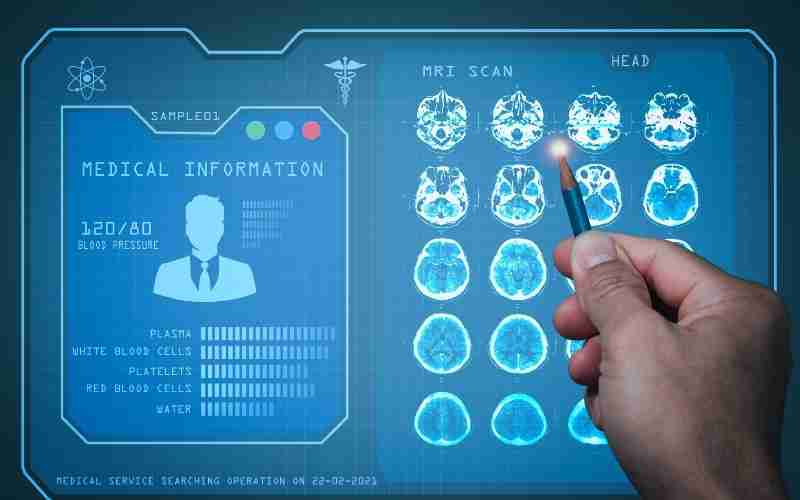 tecnologia-forca-atualizacao-diagnostico-imagem